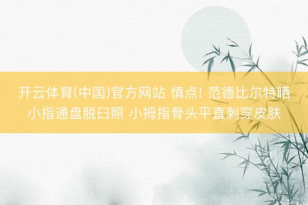 开云体育(中国)官方网站 慎点! 范德比尔特晒小指通盘脱臼照 小拇指骨头平直刺穿皮肤