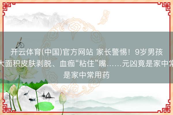开云体育(中国)官方网站 家长警惕！9岁男孩全身大面积皮肤剥脱、血痂“粘住”嘴……元凶竟是家中常用药